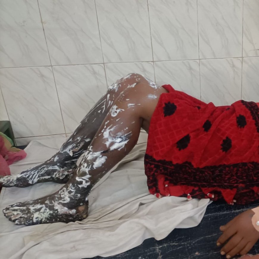 ଆମ୍ବୁଲାନ୍ସରେ ଫାଟିଲା ଅକ୍ସିଜେନ ସିଲିଣ୍ଡର, ମହିଳା ଗୁରୁତର* 